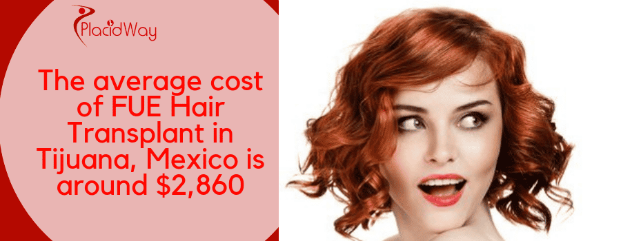 FUE Hair Transplant in Tijuana Price
